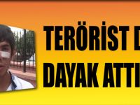 Terörist Deyip Dayak Attılar