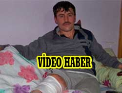 Saldırısını Kameya Kaydetti